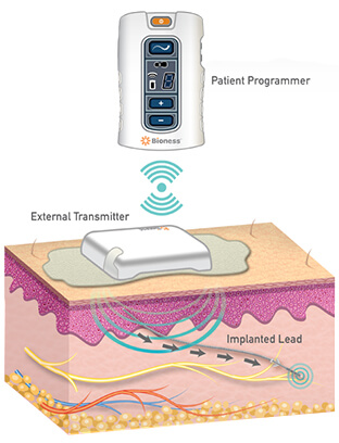 stimrouter"