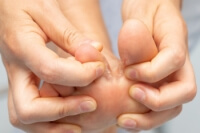 Key Facts About Children’s Athlete’s Foot