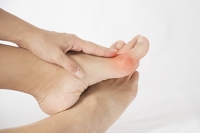 What Can Cause a Bunion?